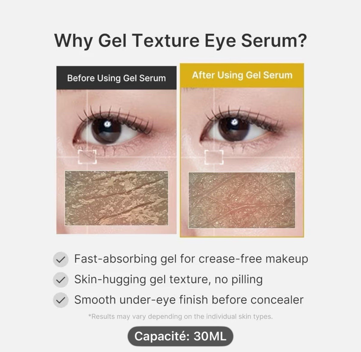 MEDICUBE Gel Contour des Yeux Curcuma Acide Kojic Rétinol Caféine 30 ml