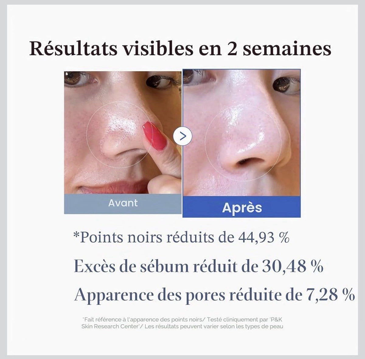 Medicube Zero Pore Pads 2.0 – AHA 4,5% & BHA – 70 Pads – Pores Affinés Peau Lisse