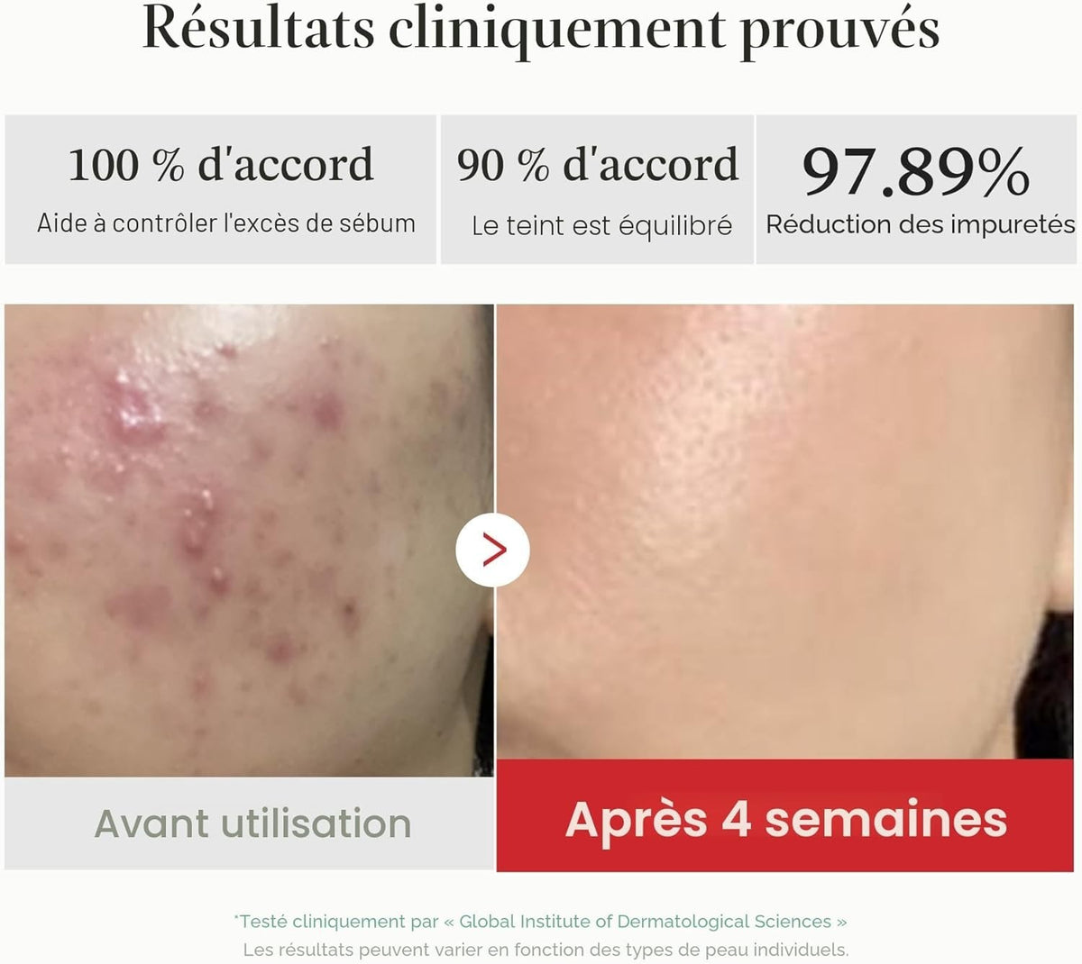 Medicube Red Succinic Acid Peeling Pads 70 unités – Anti-acné, exfoliant AHA/BHA